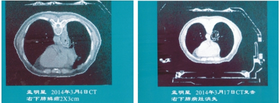 人民的好医生 中西医治癌专家苏州大学附一院名仕医院高国俊教授(图8)