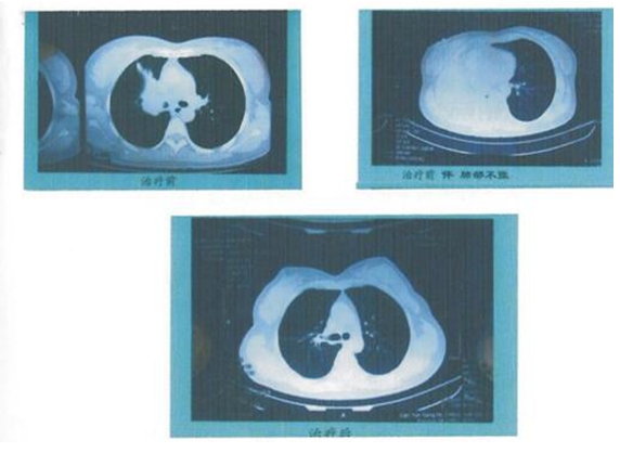 人民的好医生 中西医治癌专家苏州大学附一院名仕医院高国俊教授(图5)