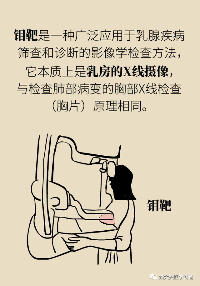 【天坛科普】钼靶和B超，检查乳腺选哪个？(图4)